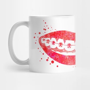 Teeth braces Mug